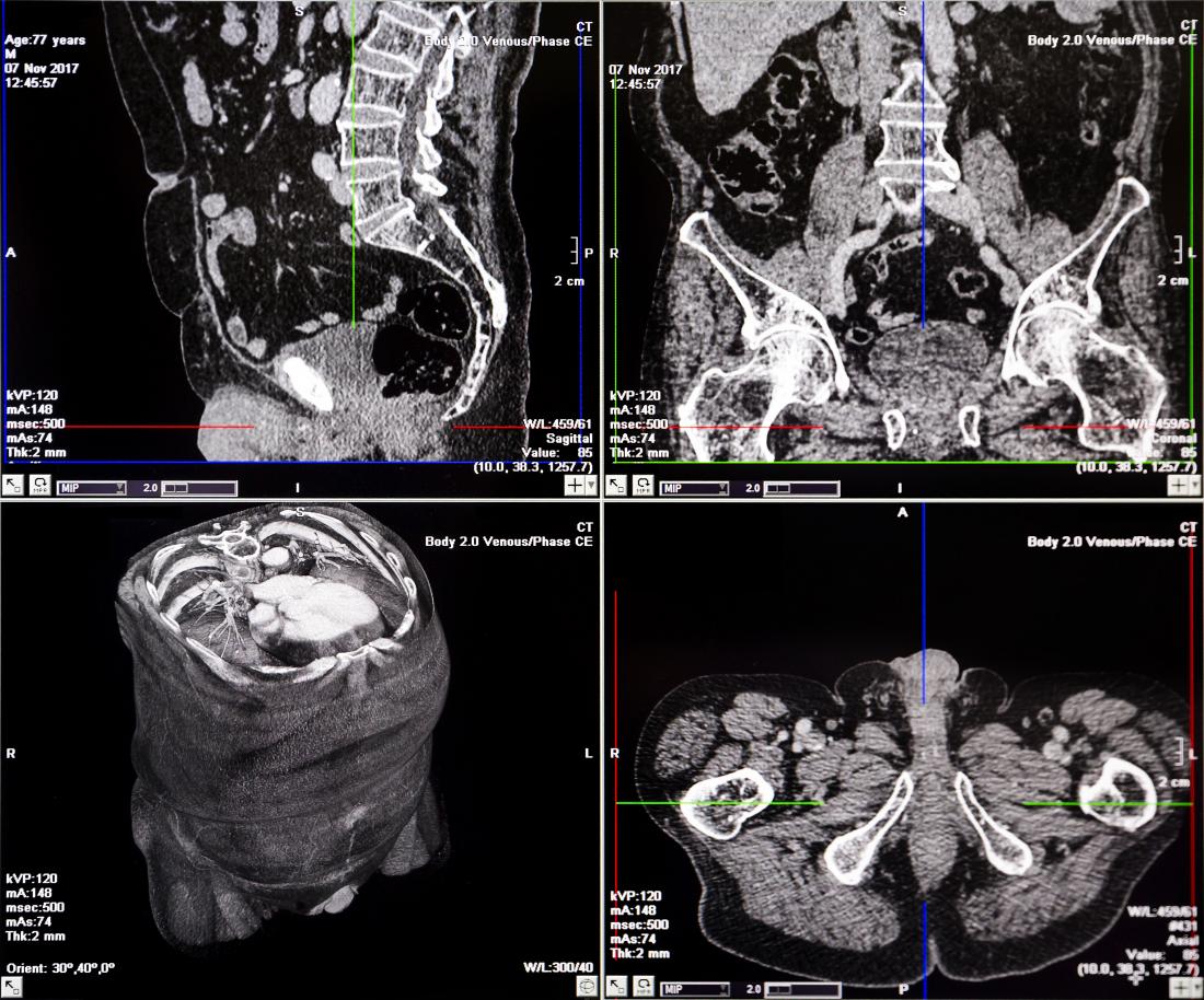 How Do Cat Scans Work