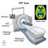 How Do Cat Scans Work: Unveiling Medical Mysteries